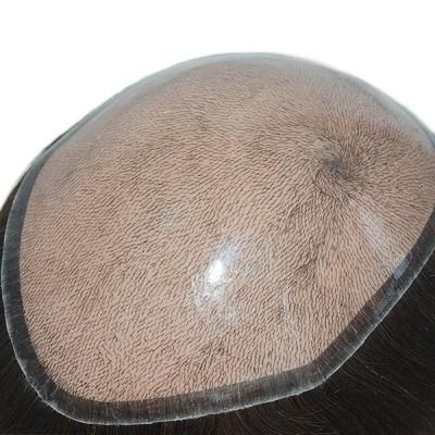 Injected Silicone Base with Natural Look and Top Quality Hair Replacement Men
