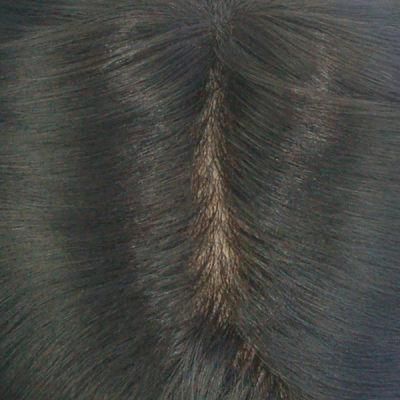 Lw363 Silk Mono Best Hair Replacement