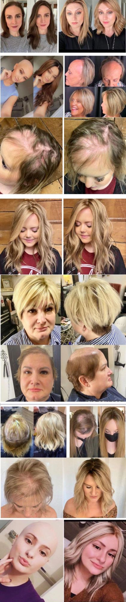 130% Density Silk Base Clip Women Toupee in Hair Pieces Crown for Slight Hair Loss Thinning Hair Cover Gray Hair -16 Inch -27p613medium Brown&Dark Blonde