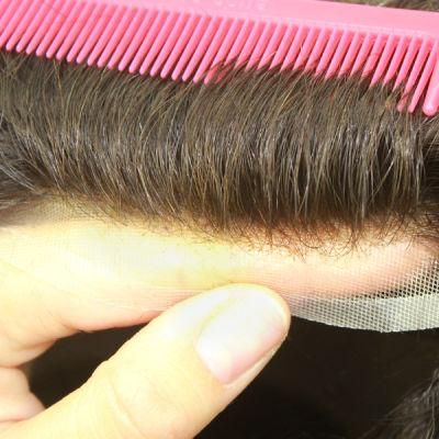 Bleached Knots Giving This Men&prime;s Hair Loss Solution an Undetectable Finish