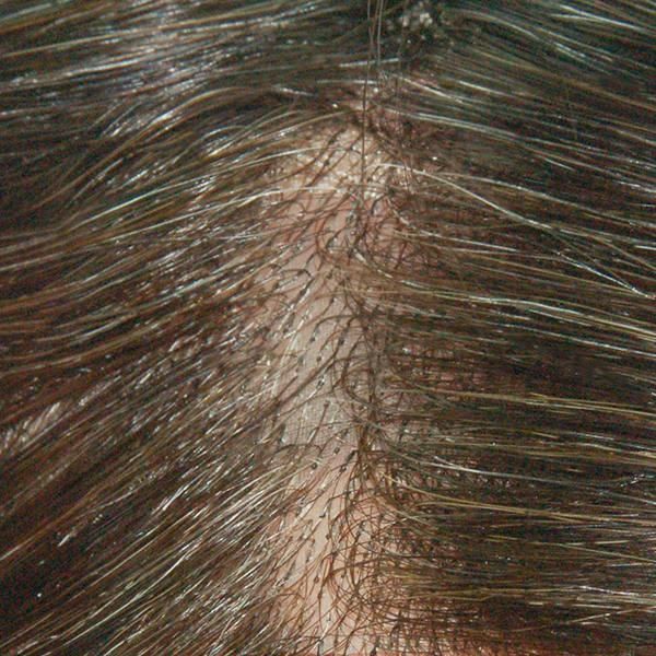 Ljc989 Skin Gause Edge Mens Hair Toupee