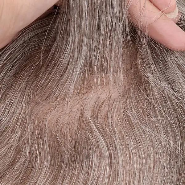 Injected Lace with Injected Skin Parting Realistic Toupee for Men