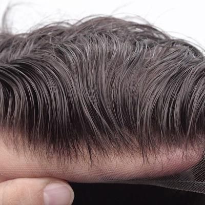 The Most Undetectable Hair Replacement System for Men