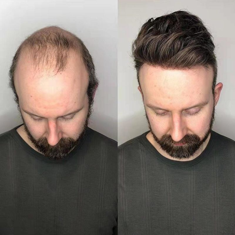 Kbeth Short Straight Men′s Toupee Human Hair Replacement Hairpiece Good Quality Factory Supply Men Toupees Ready to Ship