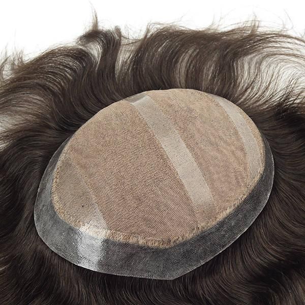 Injected Lace with Injected Skin All Around Hair Replacement Systems