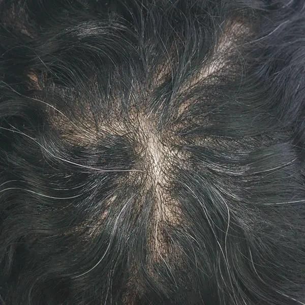 Ljc1581: Human Hair V-Looped Hair Realistic Hair Replacement Systems