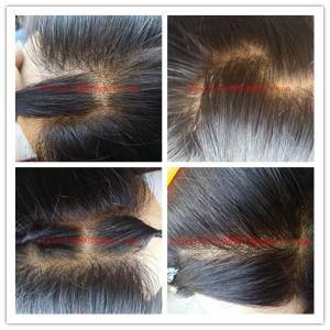2015 New Design Thin Skin Top Wig 100% Human Hair Full Lace Wig