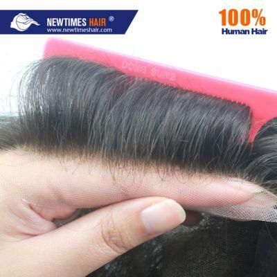 Reinforced Lace Front Conventional Top Hair Replacement System