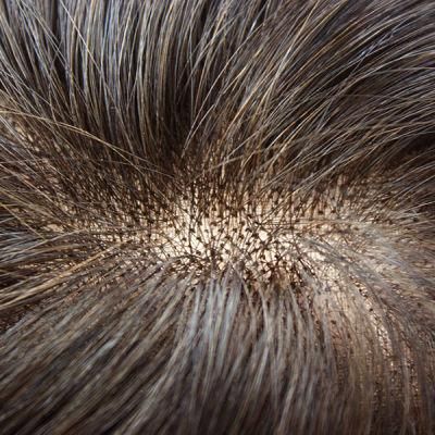 Fine Natural Hair Toupee with Npu Around Human Hair Bang