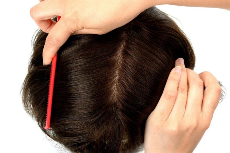 Natural Lace Injection Human Hair Replacement System