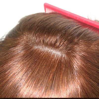 Machine Made Weft with Injected Skin Top Mono Lace Front Female Toupee
