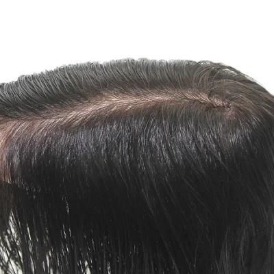 Normal Injected Skin High Quality Toupee Hair Replacement System
