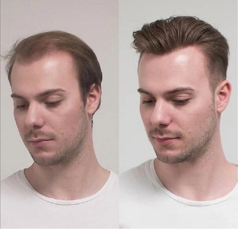 Hair Weaving Replacement Human Hair Full Hand Weaving Bio Men′s Wig