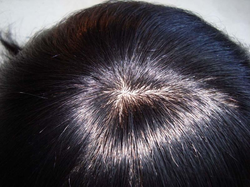 Men′s Toupee Human Hair Replacement