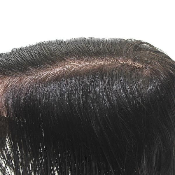 Normal Injected Skin High Quality Toupee Hair Replacement System