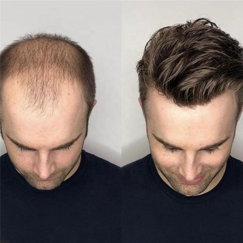 Kbeth Toupee Hotsales Remy 1b# Human Hair for Man 2021 Fashion Wholesale Vendors High Quality Full Lace Wigs Toupees for Balding Handsame Man Ready to Ship