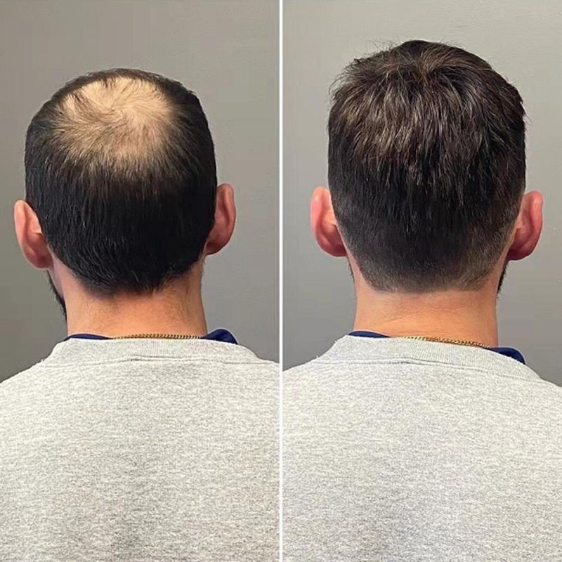 Kbeth Lace Toupees for Cool Men Human Hair Pieces Repalcement System Custom Logo Accept Good Quality Short Straight Hair Toupee Ready to Ship