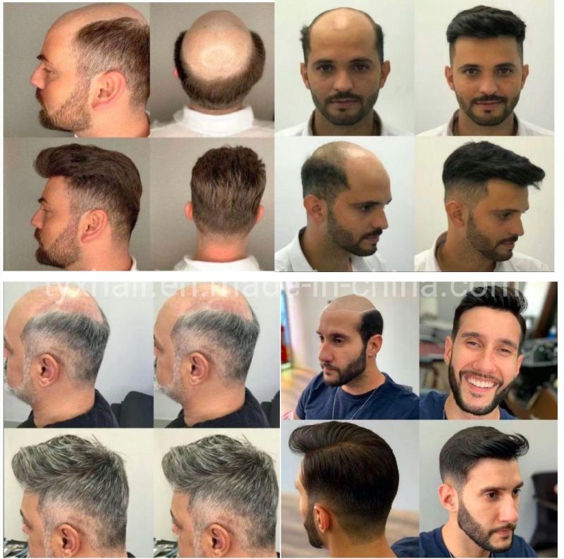 Comfortable Super Thin Skin Hair Replacement System for Men, Toupee for Hair Loss Color 4 with 20% Synthetic Hair