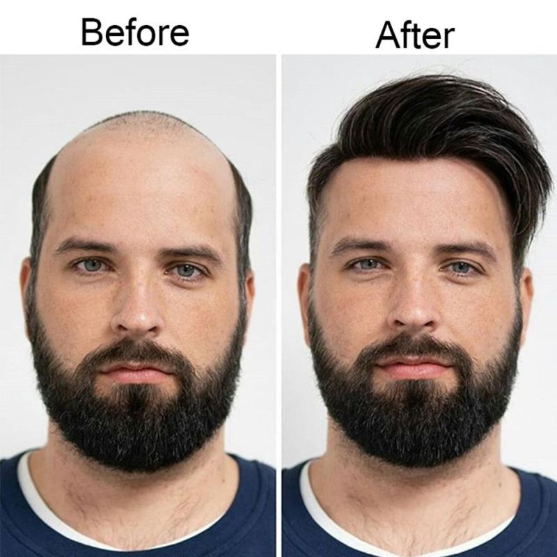 Kbeth Human Hair Wigs Most Nnatural Wholesale 100% Human Handmade Hair Full Swiss Lace Men Toupee Super Tthin Skin Invisible Toupee for Men in Stock