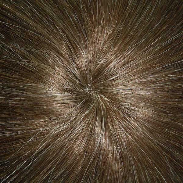 Special Color Silicon Injected Hair System