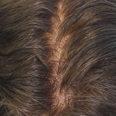 Natural Hair Line Undetecable Toupee for Men - Full Swiss Lace