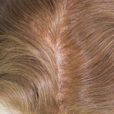Super Fine Swiss Lace Natural Human Hair Toupee