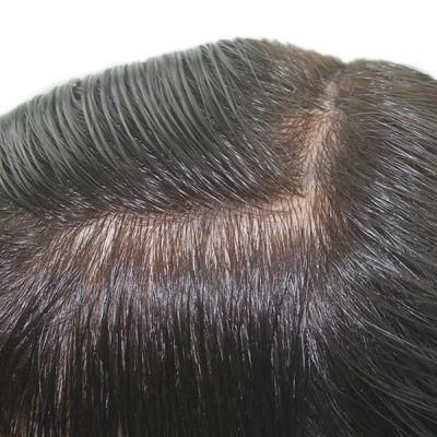 Normal Injected Skin High Quality Indian Human Hair Toupee