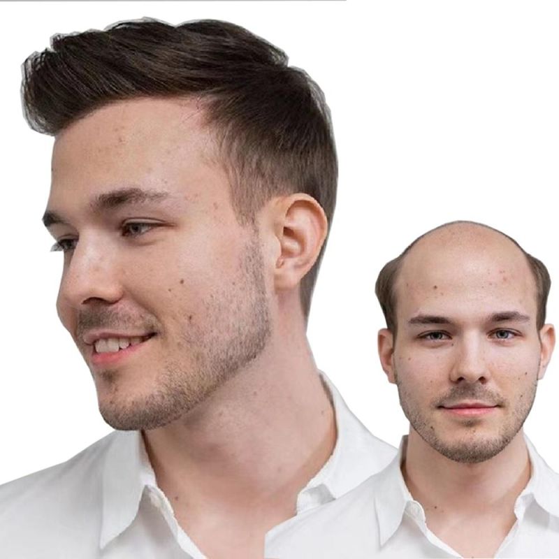 Kbeth Men′ S Wig Cool Toupees for Baldness Man Fashion Top Sale Good Quality Long Lasting Glue Transparent Skin Thin Lace Toupee Factory Supply