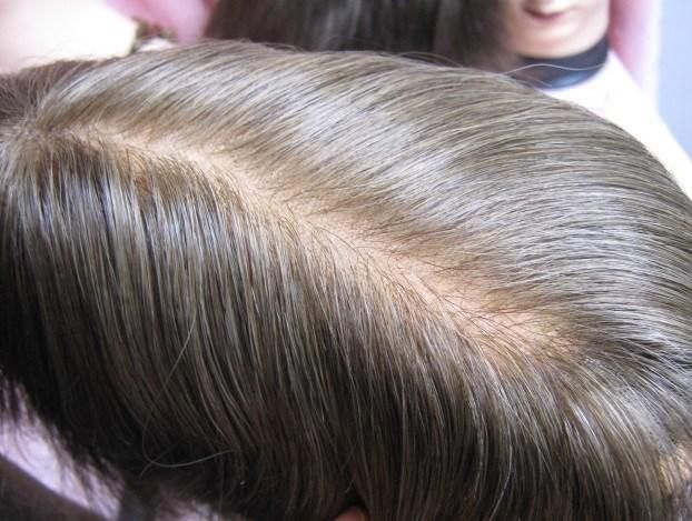 Men′s Toupee Human Hair Replacement