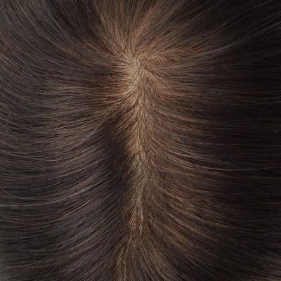 Injected Lace with Injected Skin All Around Hair Replacement Systems