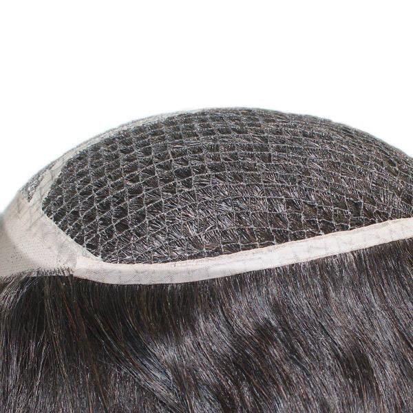 Women′s Integration Hair Replacement