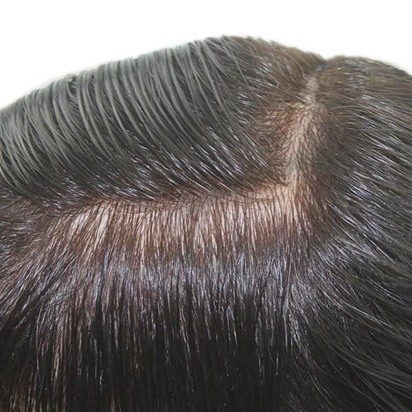 Normal Injected Skin High Quality Toupee Hair Replacement System