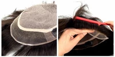 Bleached Nots Giving and Invisble Hair Line for This Men&prime;s Wig Hair Replacement System