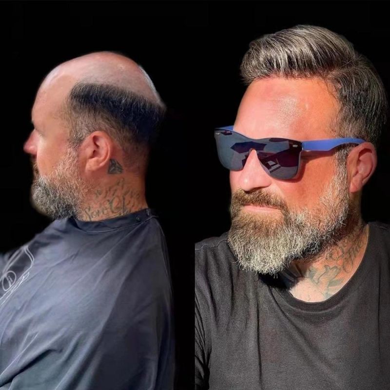 Kbeth 100% Indian Hair Silicone Base Replacement System Hair Wig for Men with Gary Toupee Human Hair Toupees for Old Men Ready to Ship