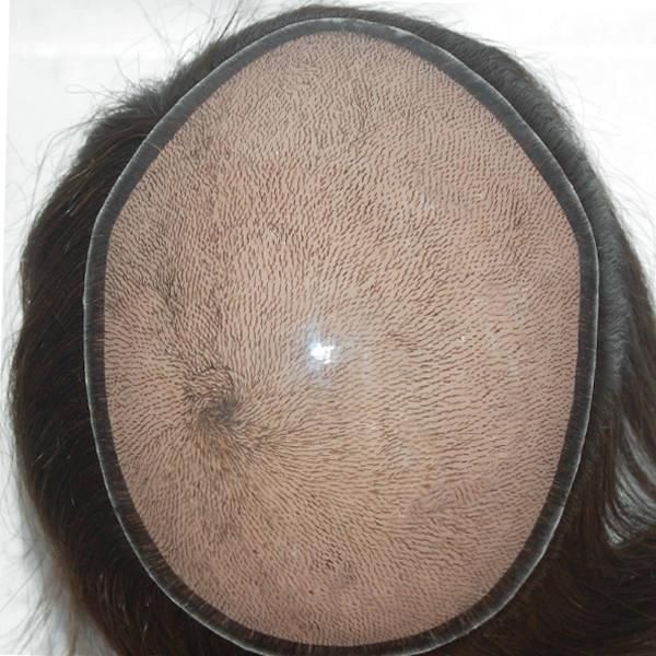 Injected Silicone Base with Natural Look and Top Quality Hair Replacement Systems