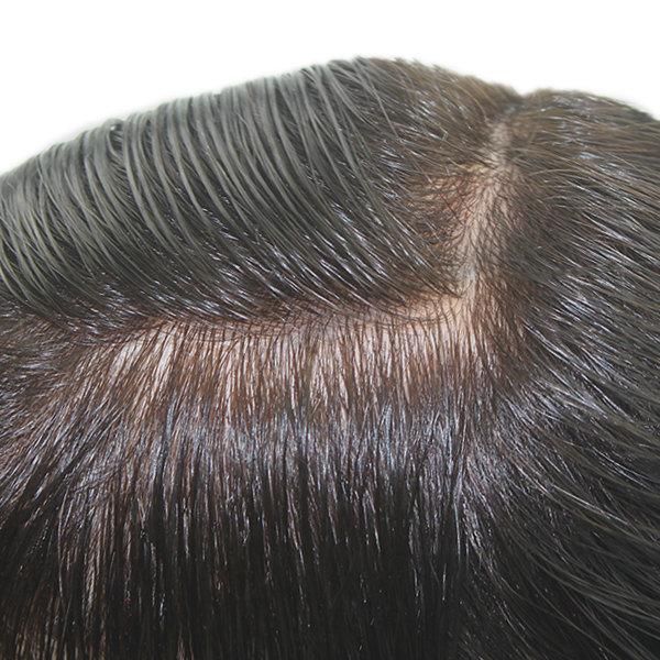 Normal Injected Skin High Quality Toupee Hair Systems