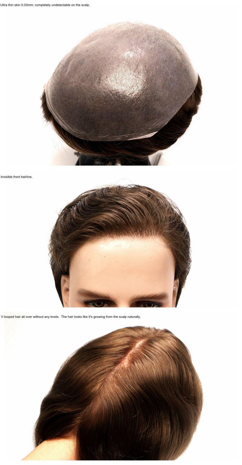 Hair Replacement