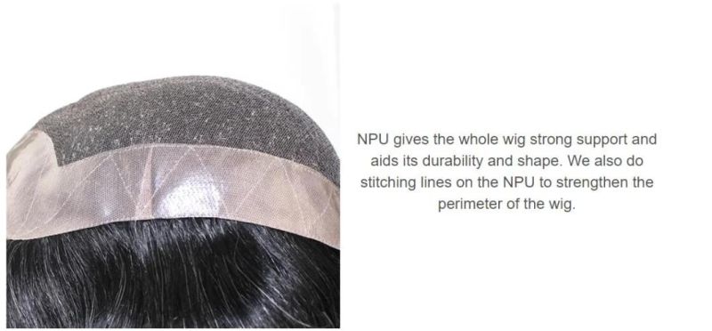 Men′s High Quality French Lace Base with Npu All Around - Hair Loss Solutions