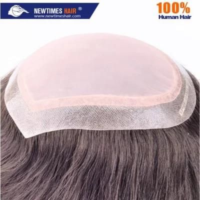 Custom Women&prime;s Silk Top and Injected Skin Hair Replacement System